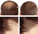 Hair Magic Corrige Falhas no Cabelo Modela Sobrancelha |COMPRE 2 LEVE 3| + Brinde especial
