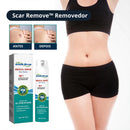 Scar Remove™ Removedor de Cicatrizes, Estrias e Marcas na Pele - |COMPRE 1 LEVE 2| + Frete Grátis