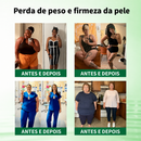 O Segredo Que as Clínicas Te Escondem: O Adesivo Que Humilha o Ozempic e o Mounjaro Sem Destruir Seu Estômago.