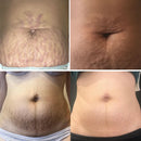 Scar Remove™ Removedor de Cicatrizes, Estrias e Marcas na Pele - |COMPRE 1 LEVE 2| + Frete Grátis