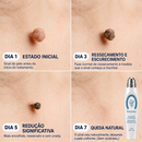 DermoSec 72h | Caneta Secativa de Verrugas Direto na Raiz