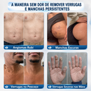 DermoSec 72h | Caneta Secativa de Verrugas Direto na Raiz