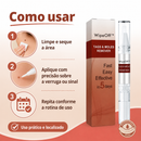 WipeOff™ Removedor de Verrugas |COMPRE 2 LEVE 3| + Frete Grátis