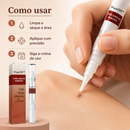 WipeOff™ Removedor de Verrugas |COMPRE 2 LEVE 3| + Frete Grátis