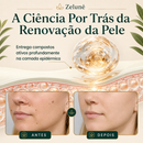 VerruZen Creme [COMPRE 1 LEVE 2] + Frete Grátis Hoje