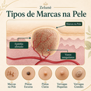 VerruZen Creme [COMPRE 1 LEVE 2] + Frete Grátis Hoje