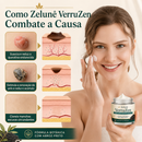 VerruZen Creme [COMPRE 1 LEVE 2] + Frete Grátis Hoje