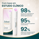 O Fim da Vergonha: Remova Sinais, Verrugas e Manchas Escuras com um Único Clique — Antes que Elas se Multipliquem.
