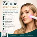 O Fim da Vergonha: Remova Sinais, Verrugas e Manchas Escuras com um Único Clique — Antes que Elas se Multipliquem.