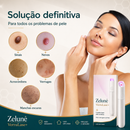 O Fim da Vergonha: Remova Sinais, Verrugas e Manchas Escuras com um Único Clique — Antes que Elas se Multipliquem.