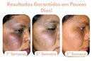 Sérum Facil para Manchas Escuras - Melanin |COMPRE 2 LEVE 3| + Frete grátis