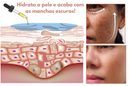 Sérum Facil para Manchas Escuras - Melanin |COMPRE 2 LEVE 3| + Frete grátis