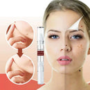 Removedor de Verrugas WipeOff™ |COMPRE 1 LEVE 2| (Oferta de Black Friday