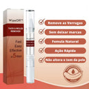 Removedor de Verrugas WipeOff™ |COMPRE 1 LEVE 2| (Oferta de Black Friday